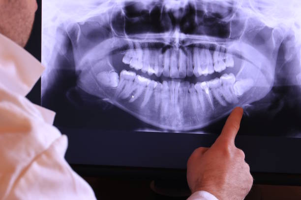 Best Broken or Chipped Tooth Repair in Wade, MS